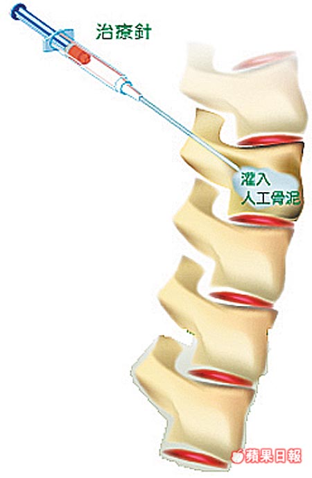 bone02.jpg