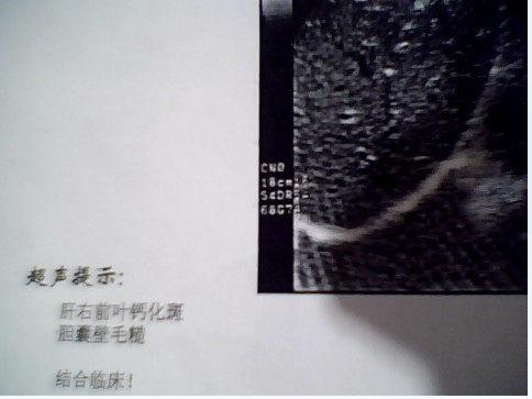 未命名17.jpg