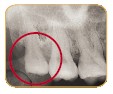 teeth01.jpg