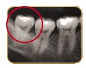 teeth02.jpg