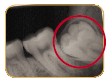 teeth03.jpg