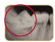 teeth04.jpg