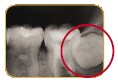 teeth06.jpg