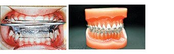 teeth07.jpg