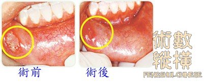 teeth13.jpg