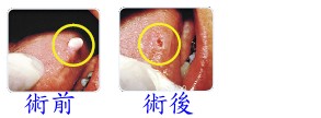 teeth14.jpg