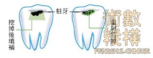teeth15.jpg