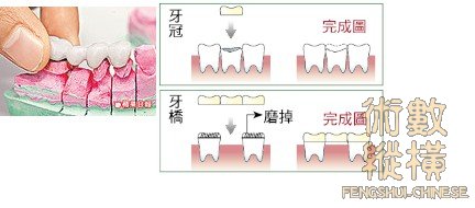 teeth23.jpg