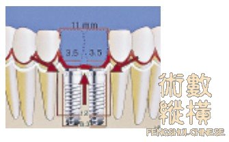 teeth25.jpg