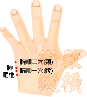 頸部扭傷 - 落枕003.gif