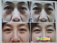 臥蠶.jpg