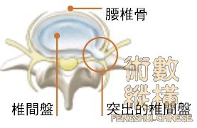 bone02.jpg
