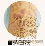 紫斑病.jpg